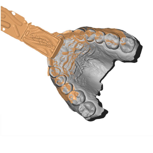 alt="arcata dentale scansionata con axioprisa"